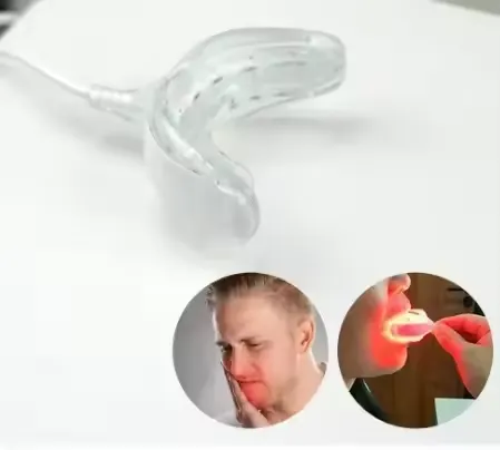 Aura Shield Dual-Light Oral Therapy & Whitening System - Image 4