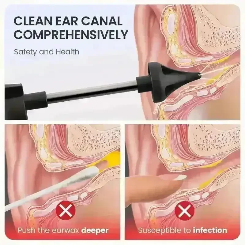Hydro Helper Ear Wax Removal Kit - Image 6